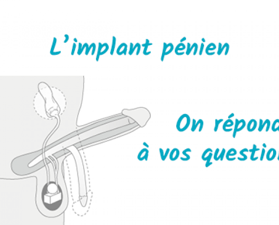 implant penien