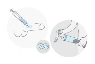 Illustration d'injection caverneuse et viagra