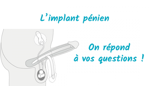 implant penien